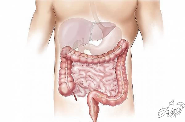 کندر برای روده